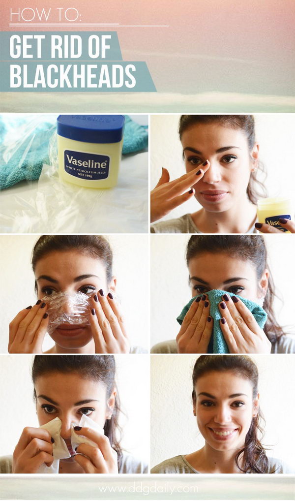 Get Rid of Blackheads with Vaseline and Clear Plastic . 